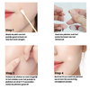 PimplePatch™ |  Snelle hulp bij puistjes!