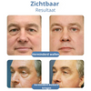 OPENEYES™ l Nooit meer rimpels!